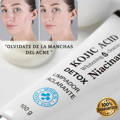 KOJIC ACID™ | Jabón Aclarante Con Ácido Kojico